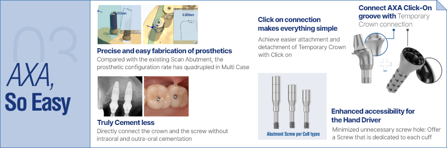 AXA Abutment