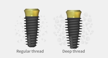 AnyOne® Onestage — Variedade de implantes para uma estabilidade inicial previsível