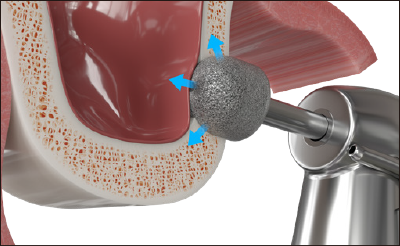 Broca de Diamante Avançada