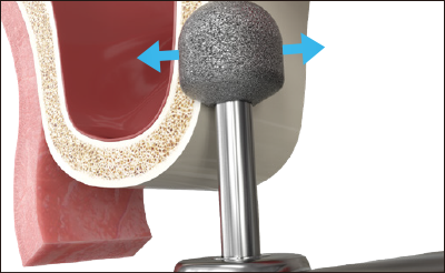 Broca de Diamante Avançada