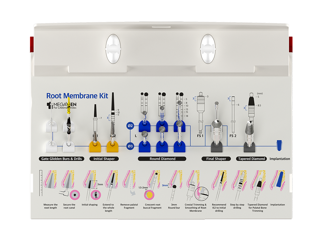 MegaGen Kit