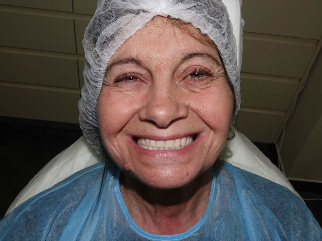 Full-Arch Implant Rehabilitation of the Atrophic Maxilla and Mandible Using MegaGen® Implants and Osseodensification — Abstract