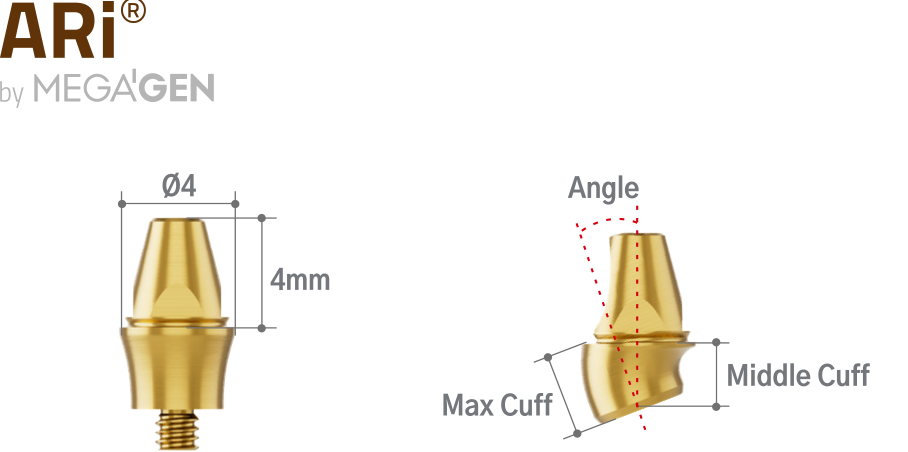 AXA Abutment