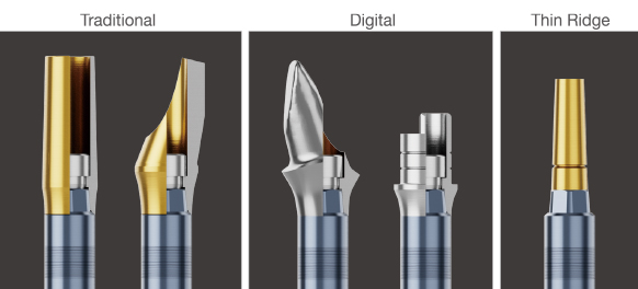 diferenças nos implantes