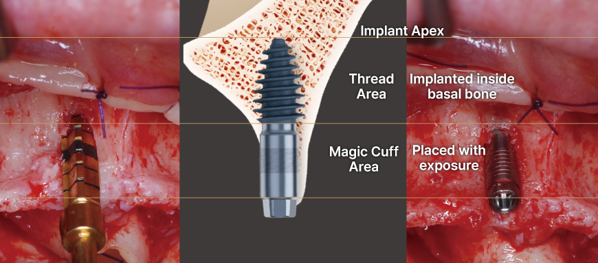ari exemplo prático