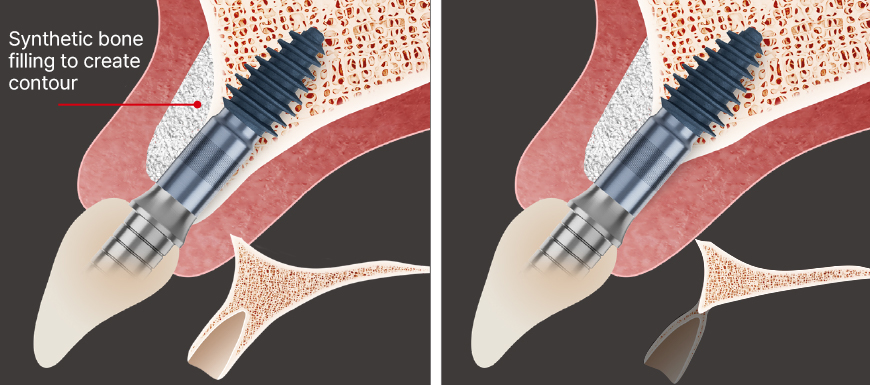 ari exemplo prático