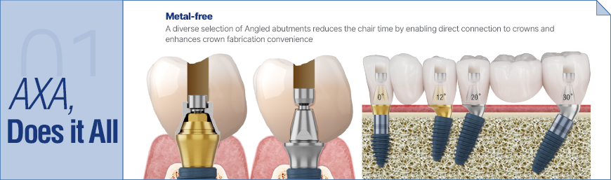 AXA Abutment
