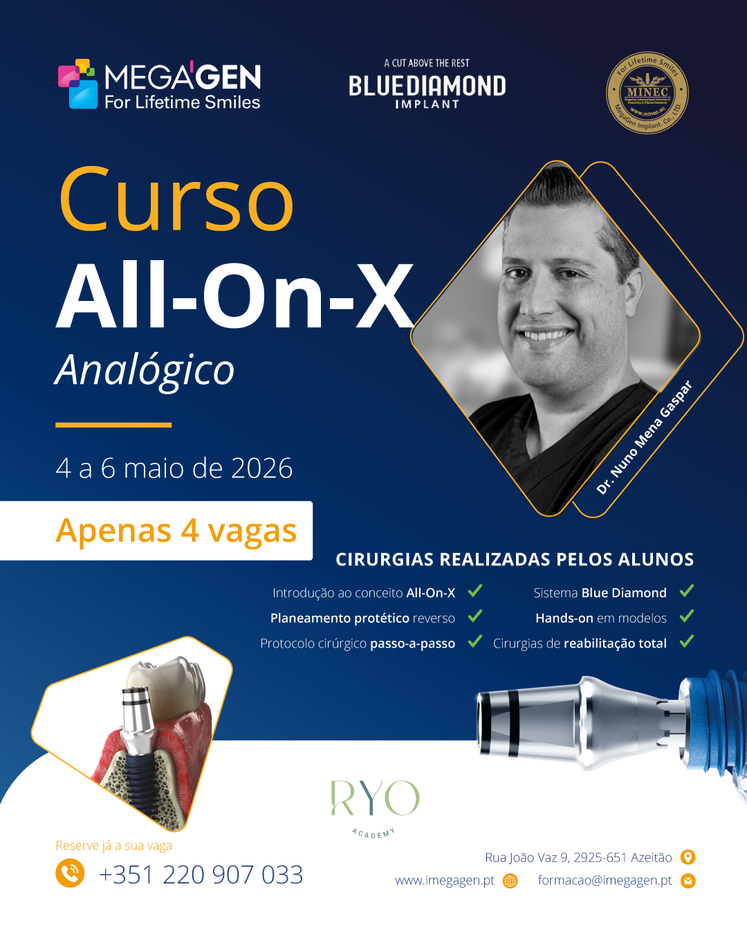 Curso All-On-X Analógico Dr. Nuno Mena Gaspar