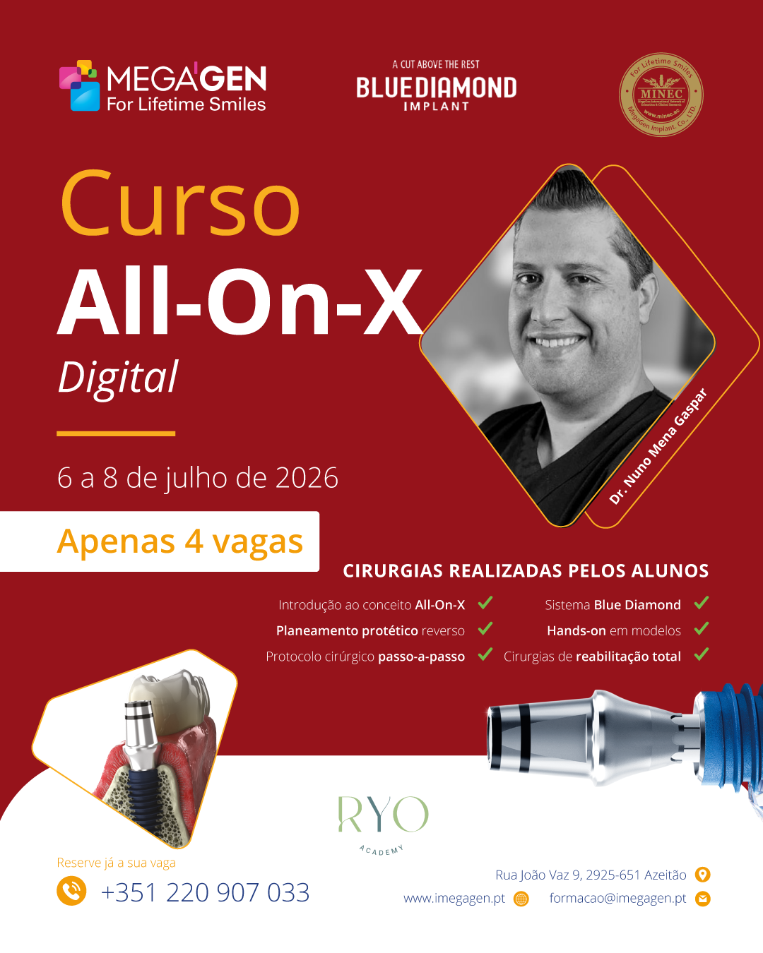 Curso All-On-X Digital com Dr. Nuno Mena Gaspar